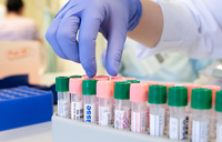 Streiks bei Synlab erfolgreich